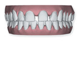 image teeth 02